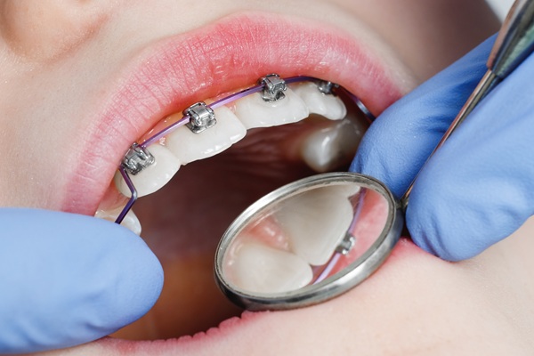 Teenager smiling with braces
