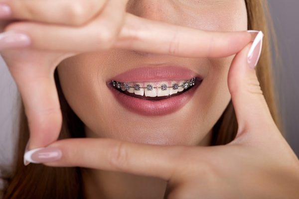 How Accelerated Orthodontic Treatment Works