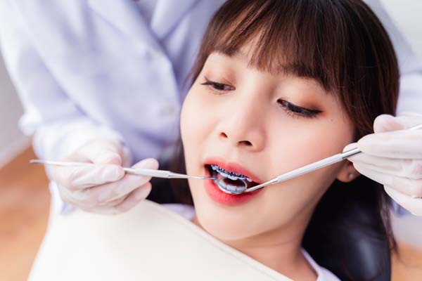 Benefits Of Adult Orthodontics