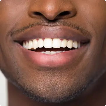 Adult Orthodontics