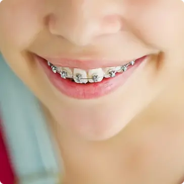 Bite Correction