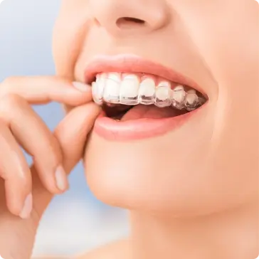 Invisalign Specialist