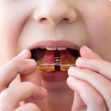 Phase One Orthodontics