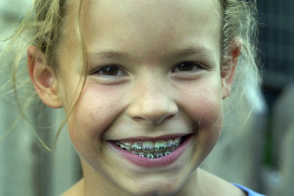 What Parents Need To Know About Kids Braces