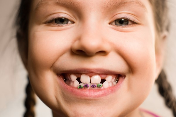 Visit A Kids Orthodontist To Discuss Teeth Straightening Options