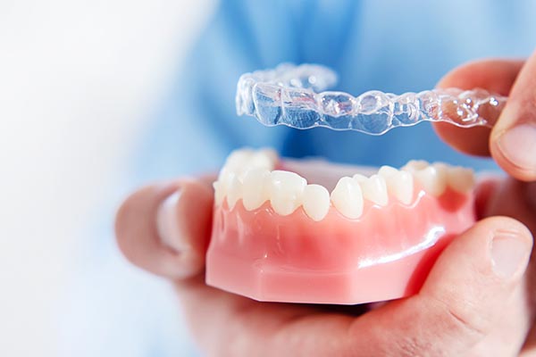 An Orthodontist Shares Reasons Clear Aligners May Be Right For You