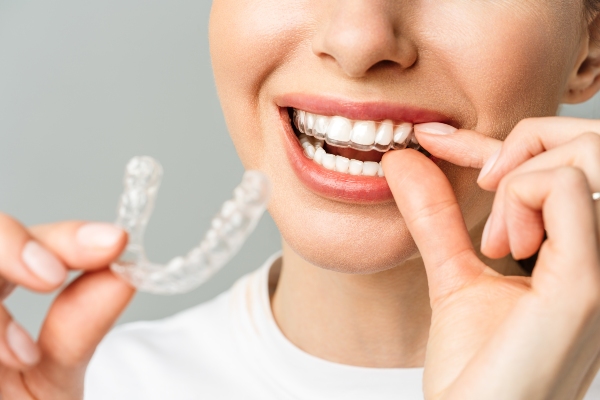 Should I Choose Braces or Clear Aligners? from Price Family Orthodontics in Frisco, TX